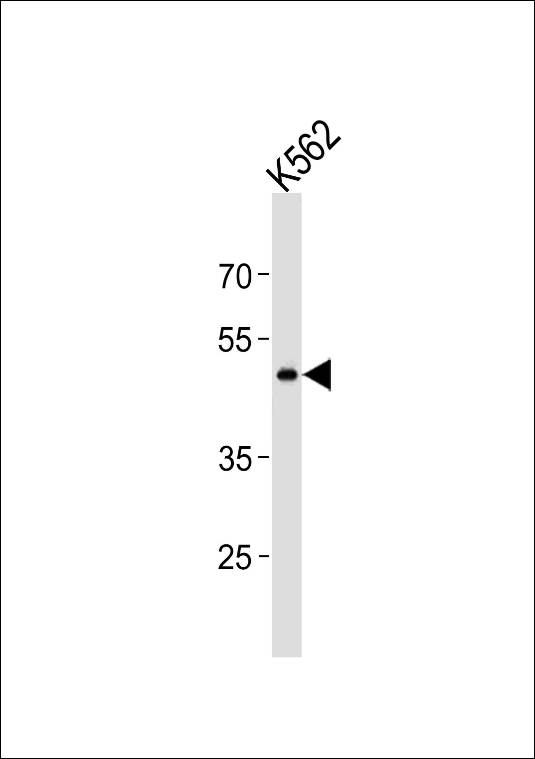 GPR150