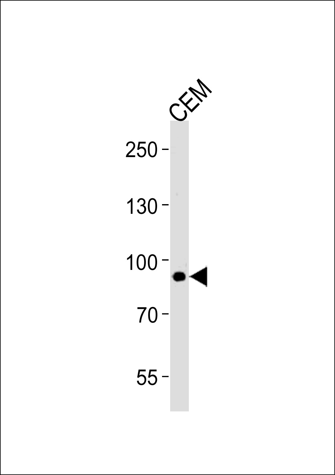 MATN2