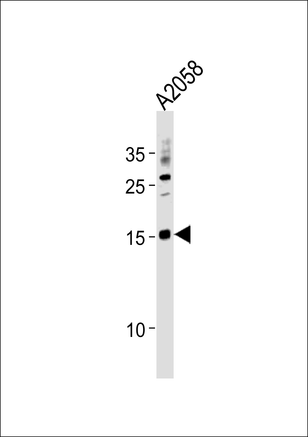 SSNA1 (N-term)