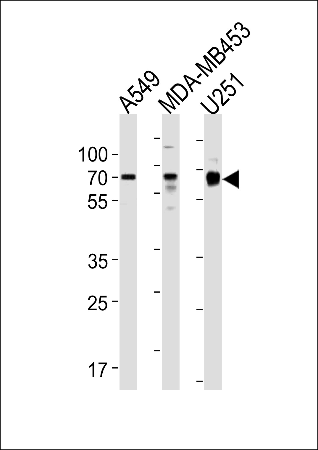GRB10 (N-term)