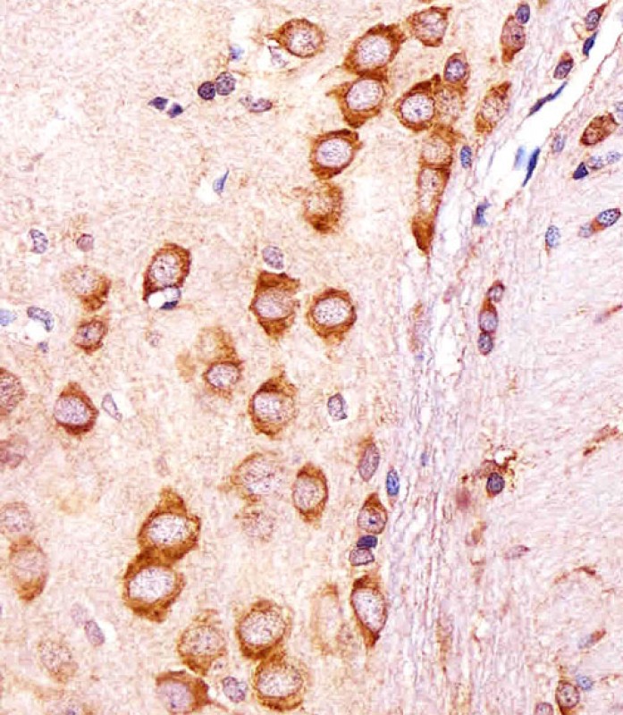 Rabbit Polyclonal Antibody to R Cgref1