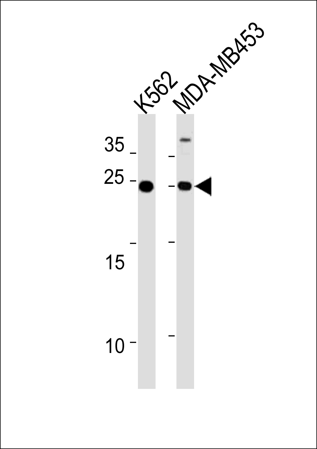 SSPN (N-term)