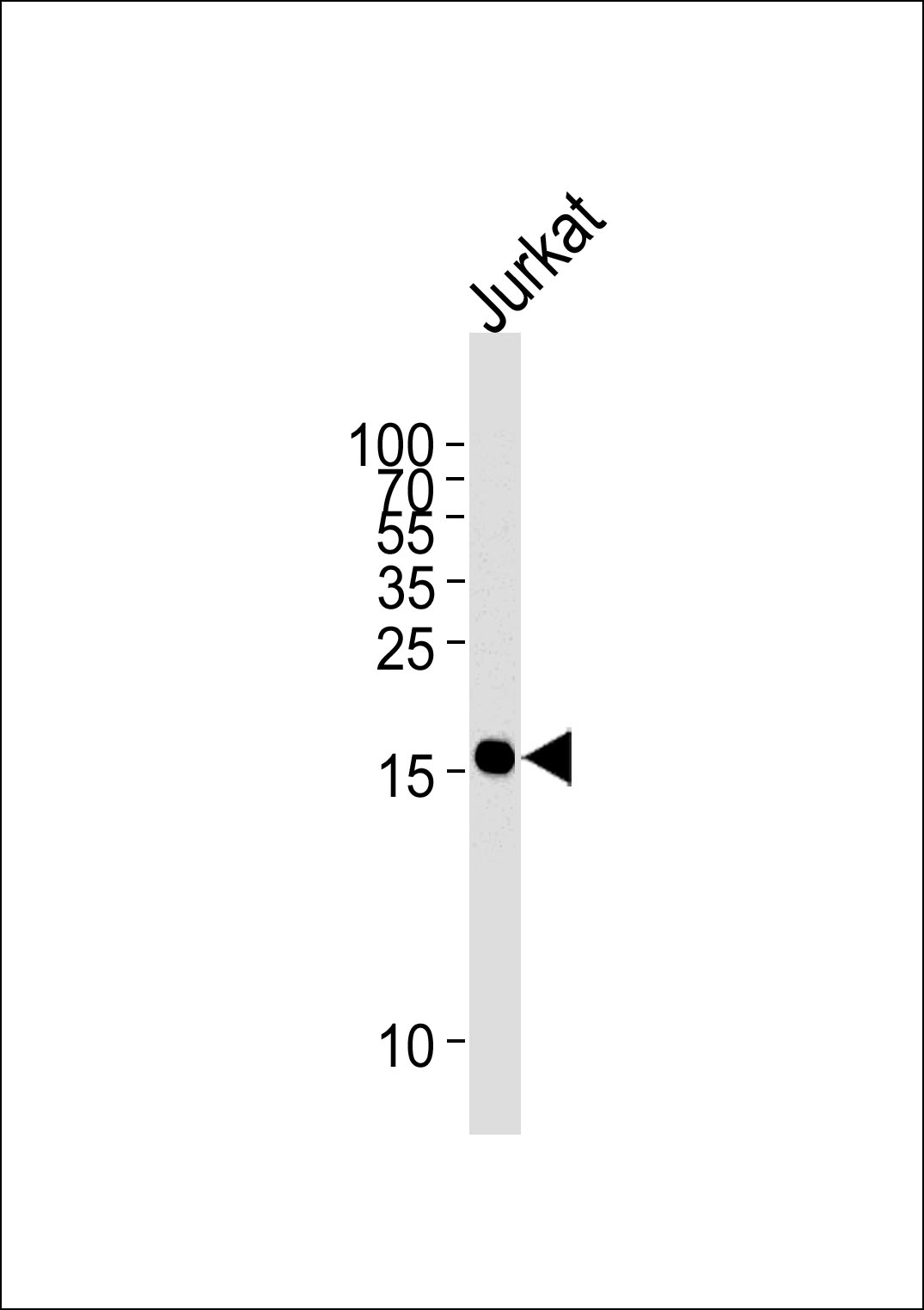 GMFG(Ascites)