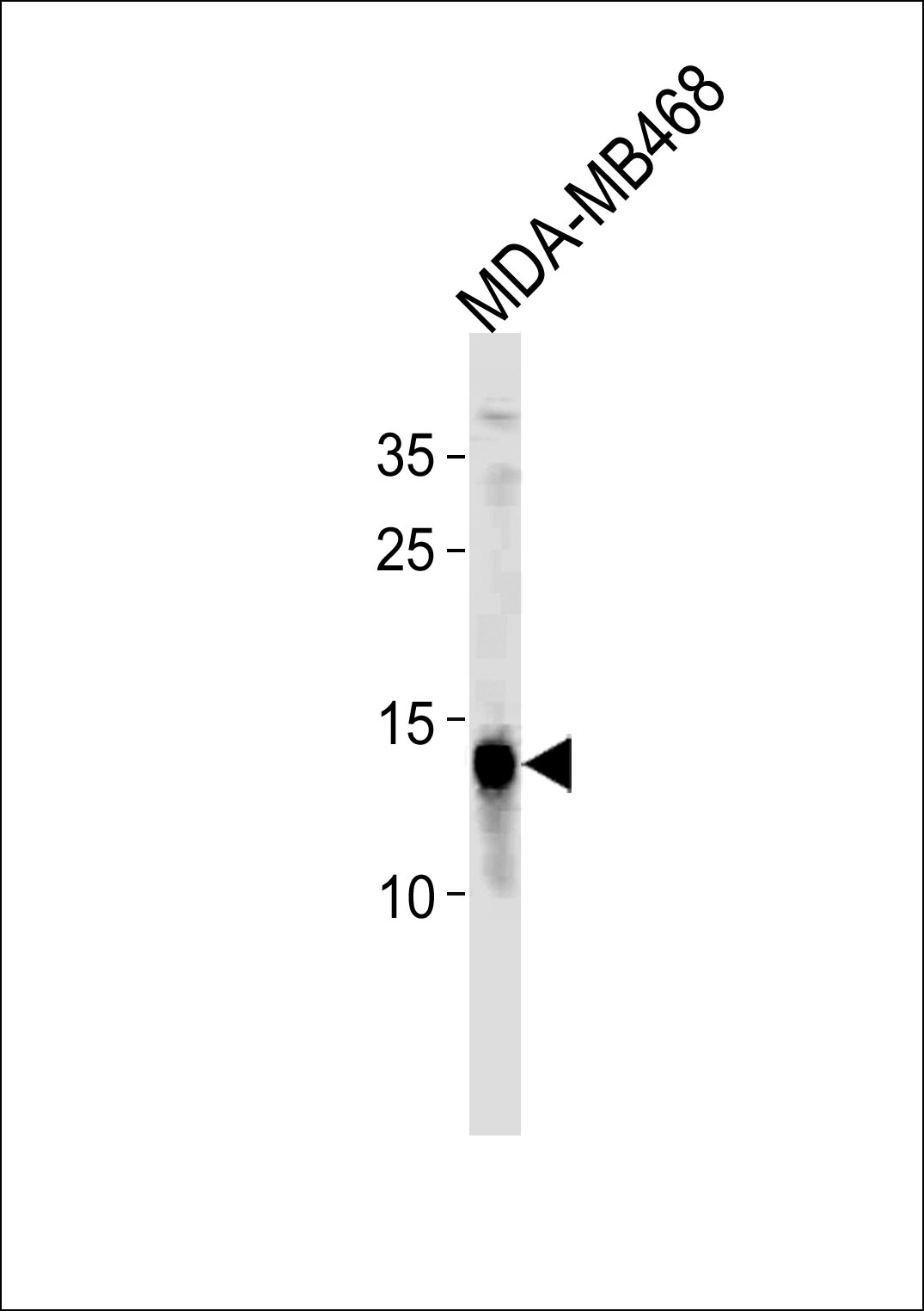 TPD52L3 (N-term)
