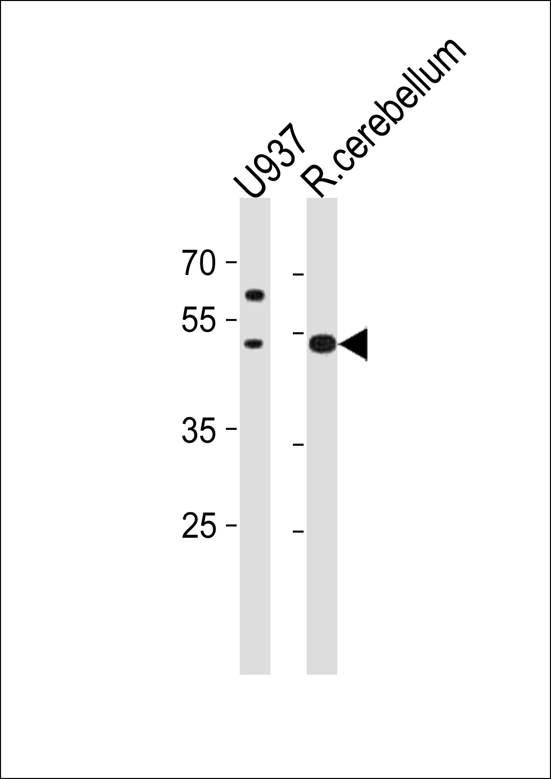 SLC25A25 (N-term)