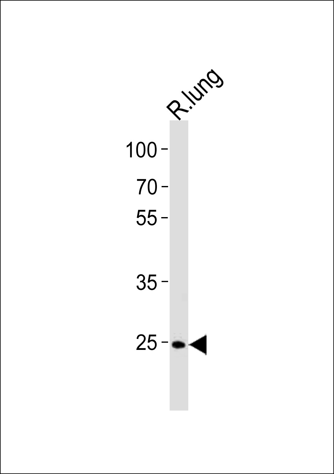 R Cdk4