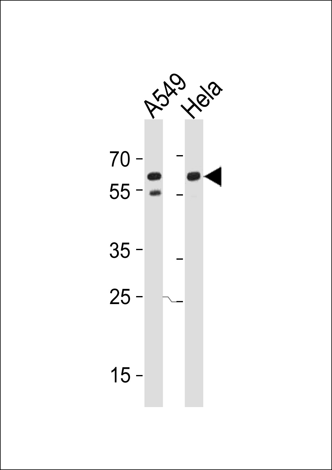 CD46 (Center Y354)