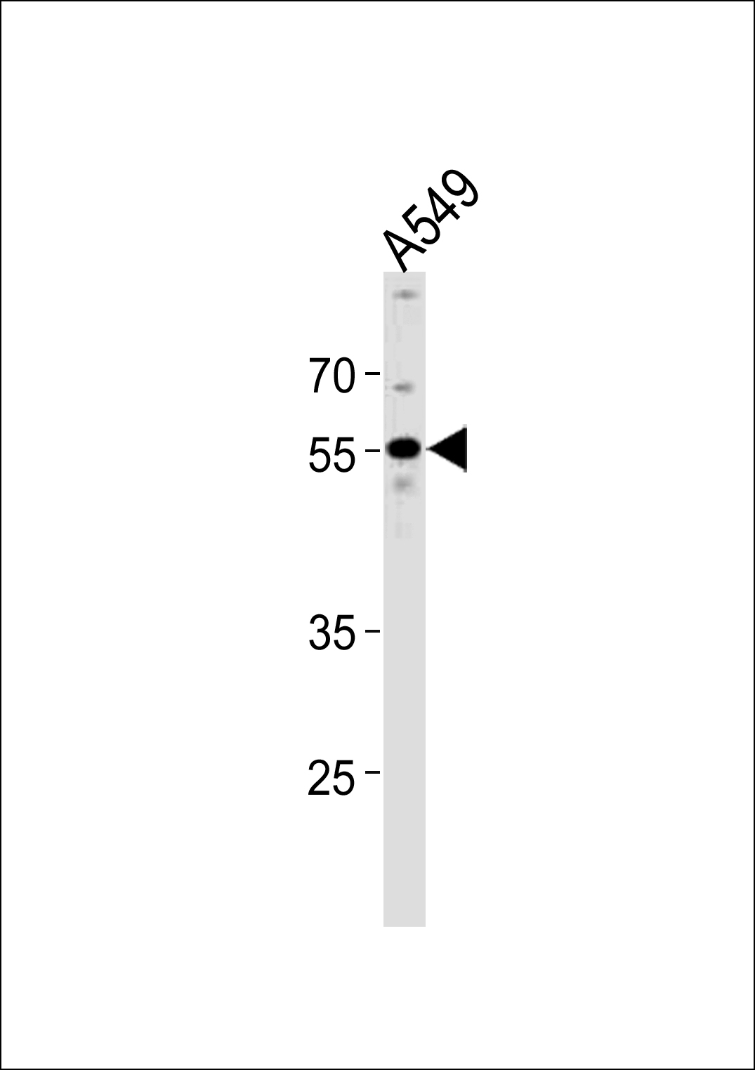 PPHLN1 (N-term)