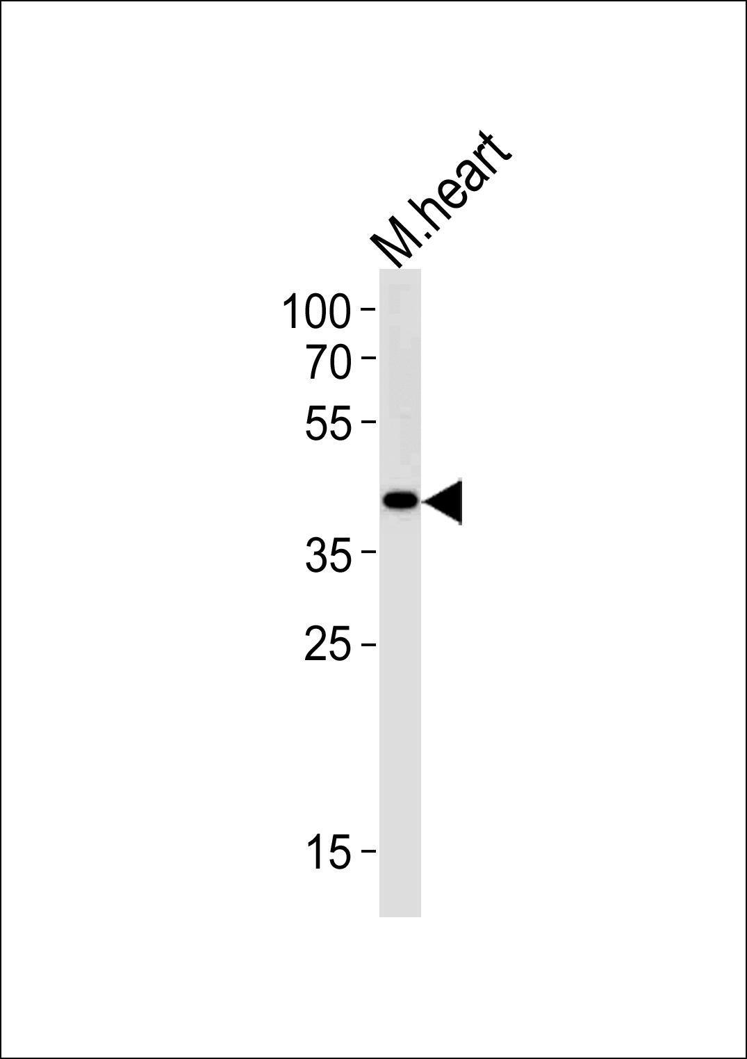M Tfap2c (N-term)