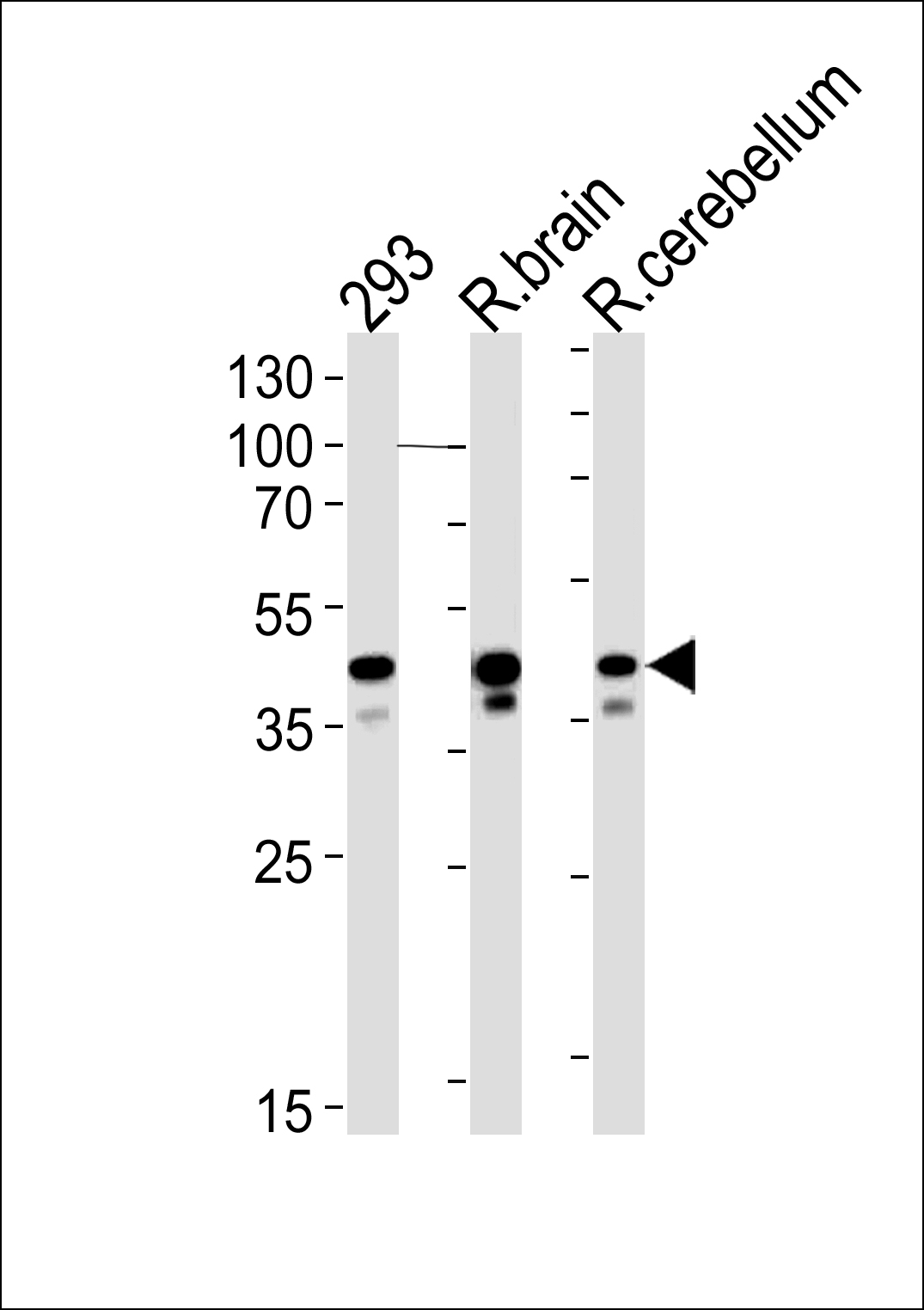 R Csnk2a1 (N-term)