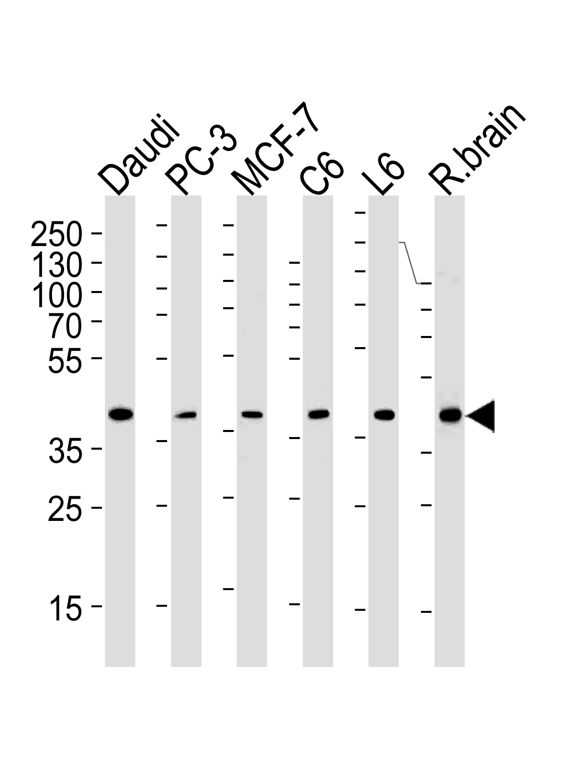CREB3L4 (M01)
