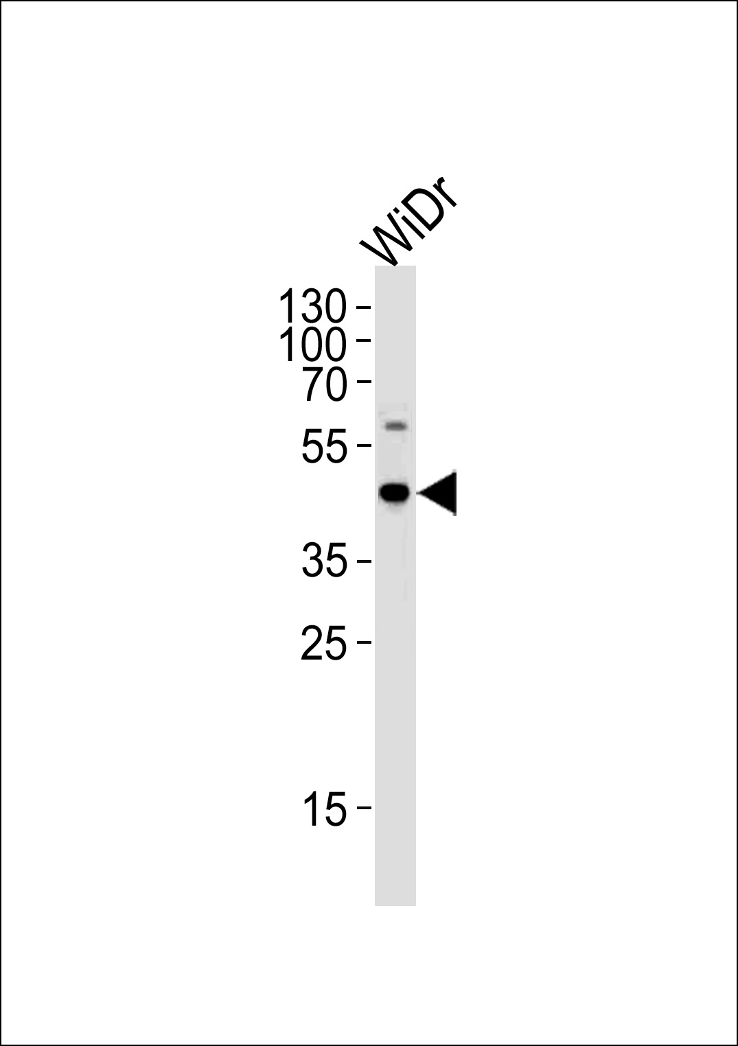 C9orf72
