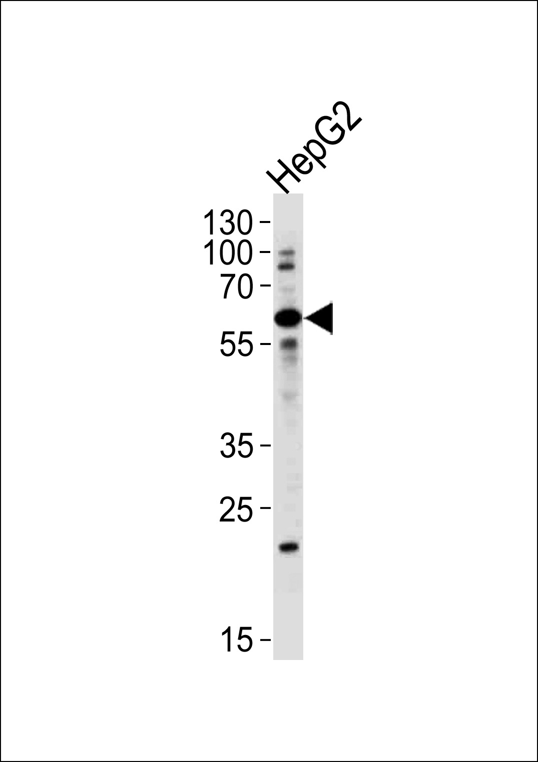 ZNF192
