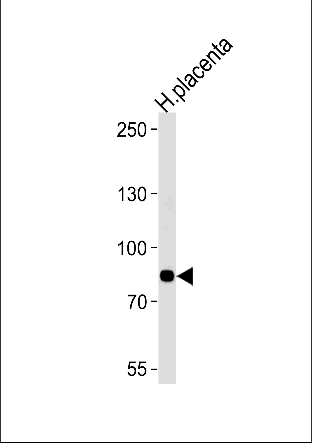 AMPD3