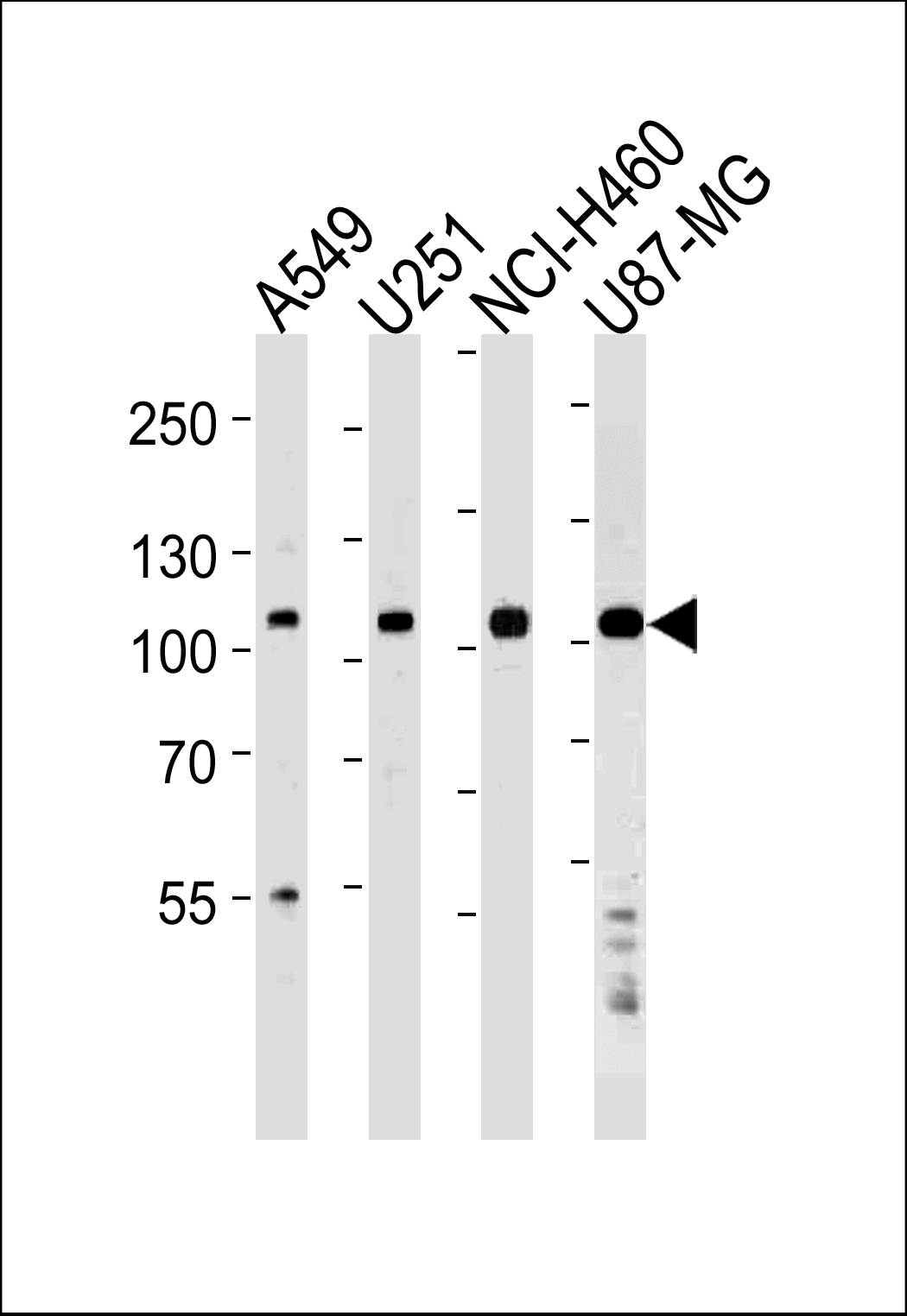 ZNF41 (N-term)