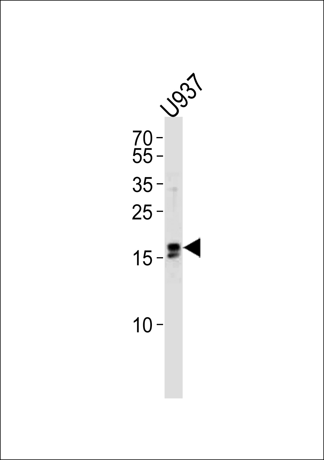 IQCF6 (N-term)