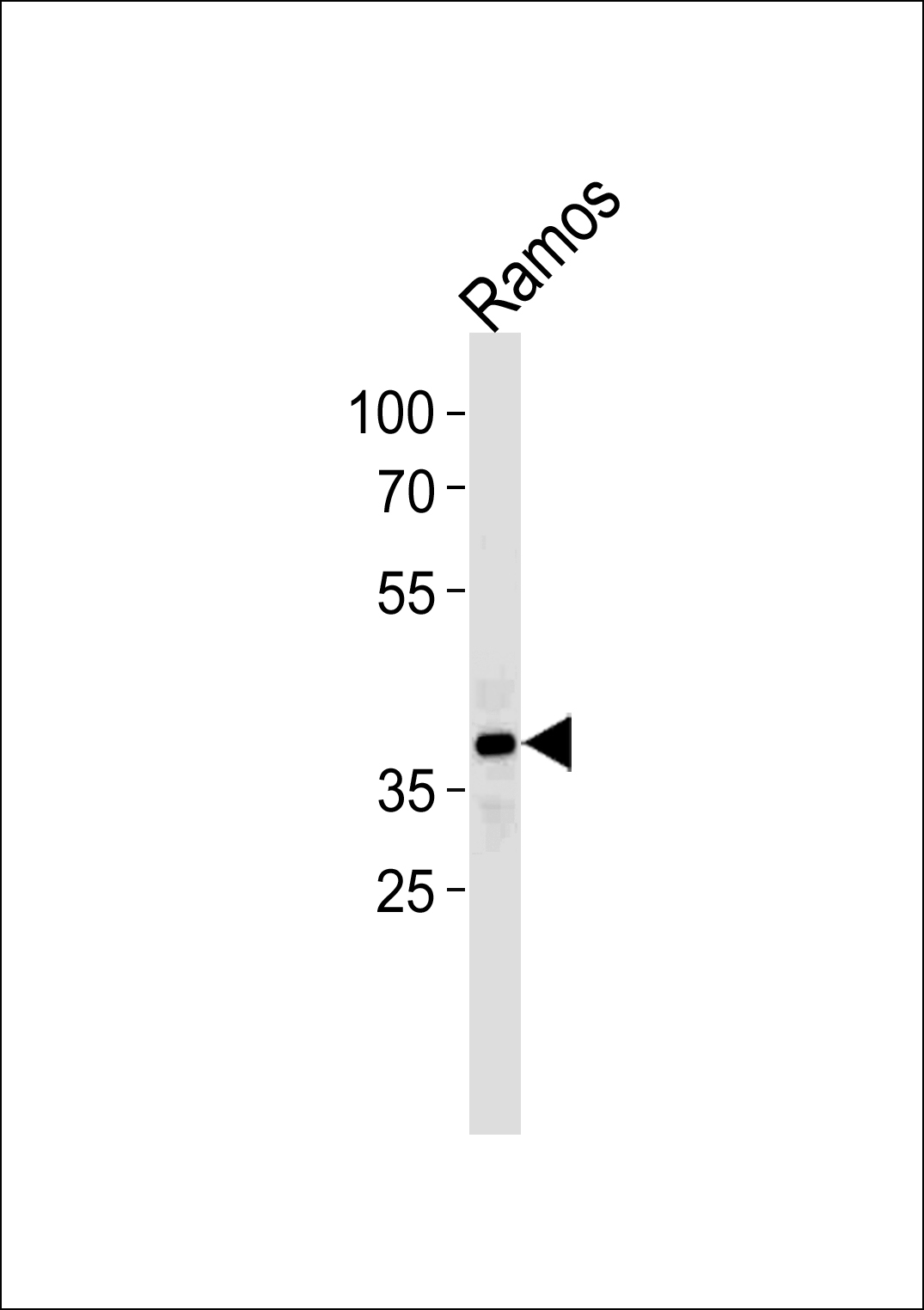 PHF11