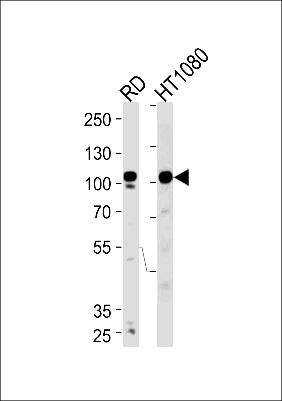 ATP2A1