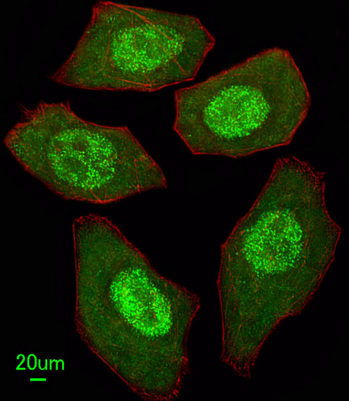 Rabbit Polyclonal Antibody to FANCC