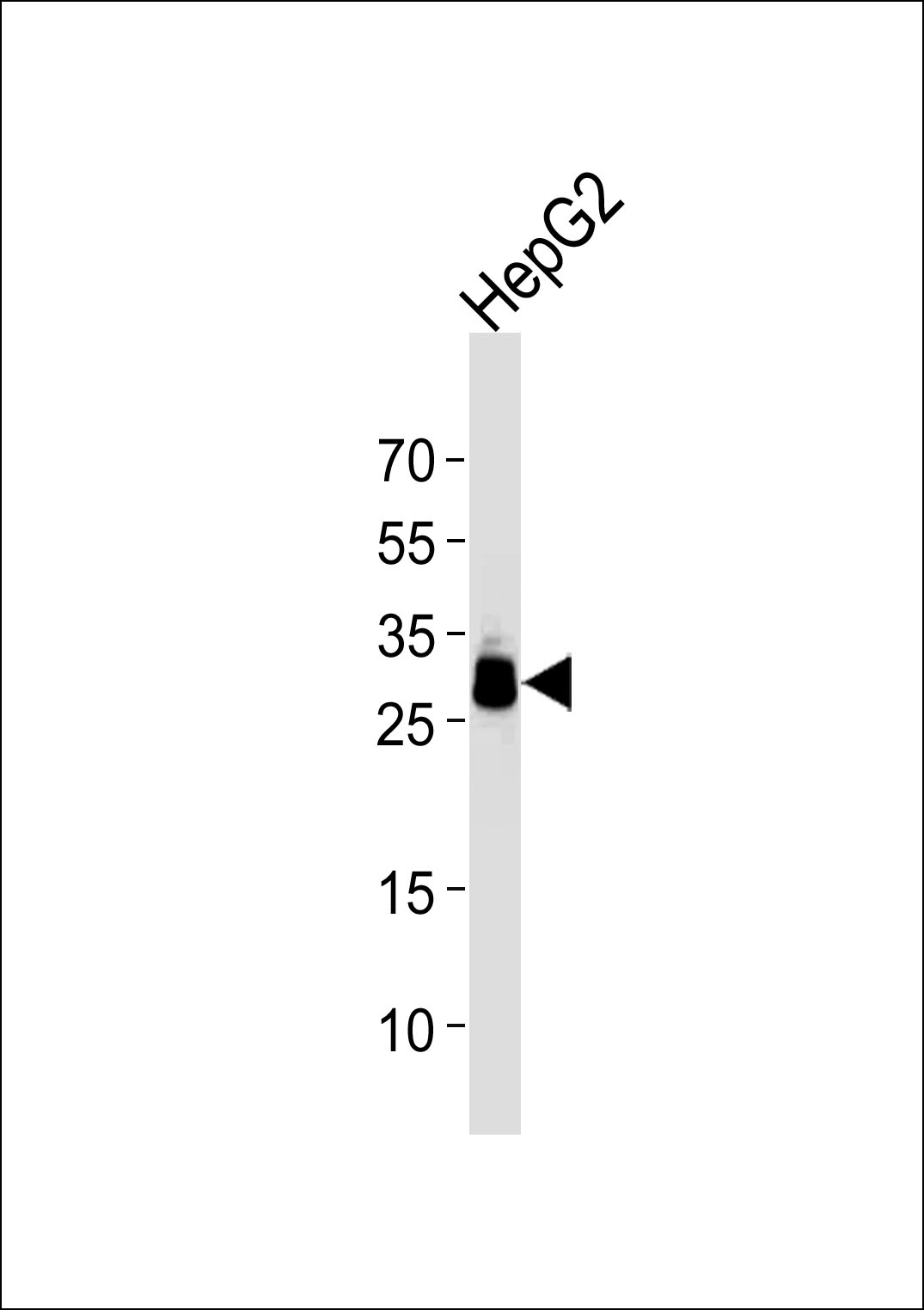 PPT1