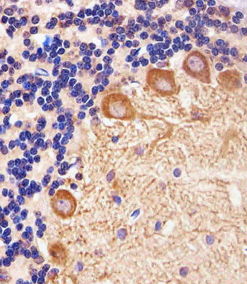 Mouse Monoclonal Antibody to PPT1