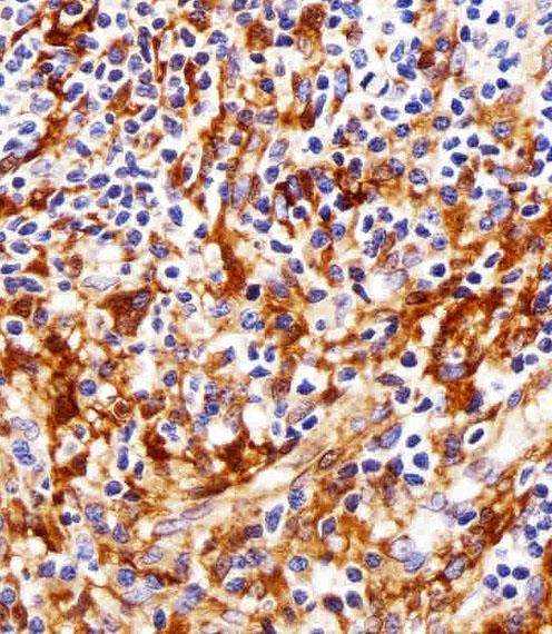 Mouse Monoclonal Antibody to FYN