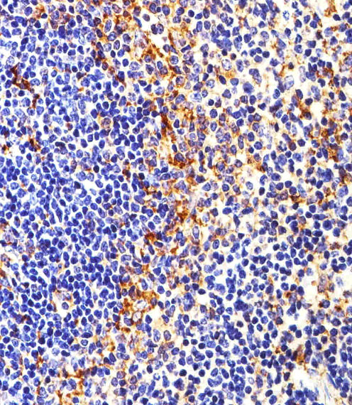 Mouse Monoclonal Antibody to FYN