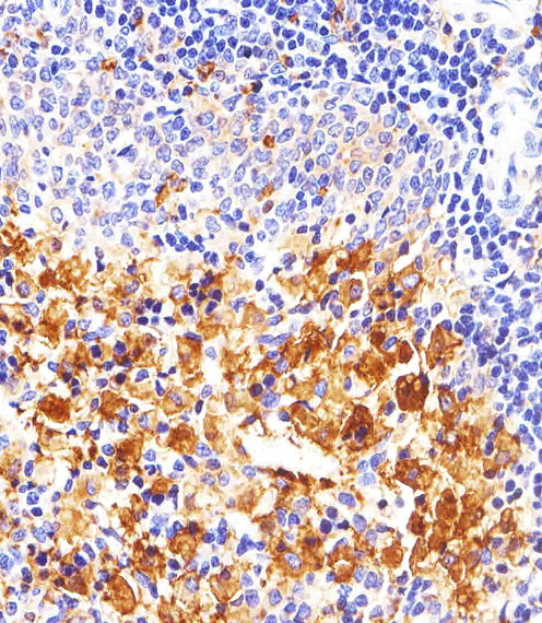Mouse Monoclonal Antibody to FYN