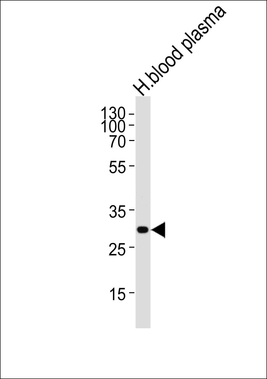 C1QA