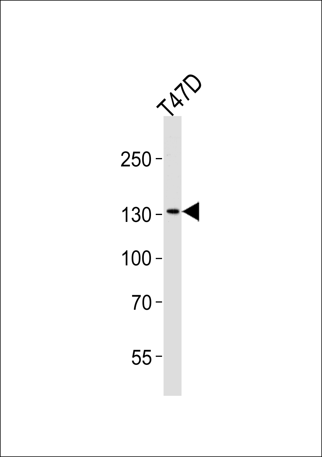 ATAD2 (N-term)