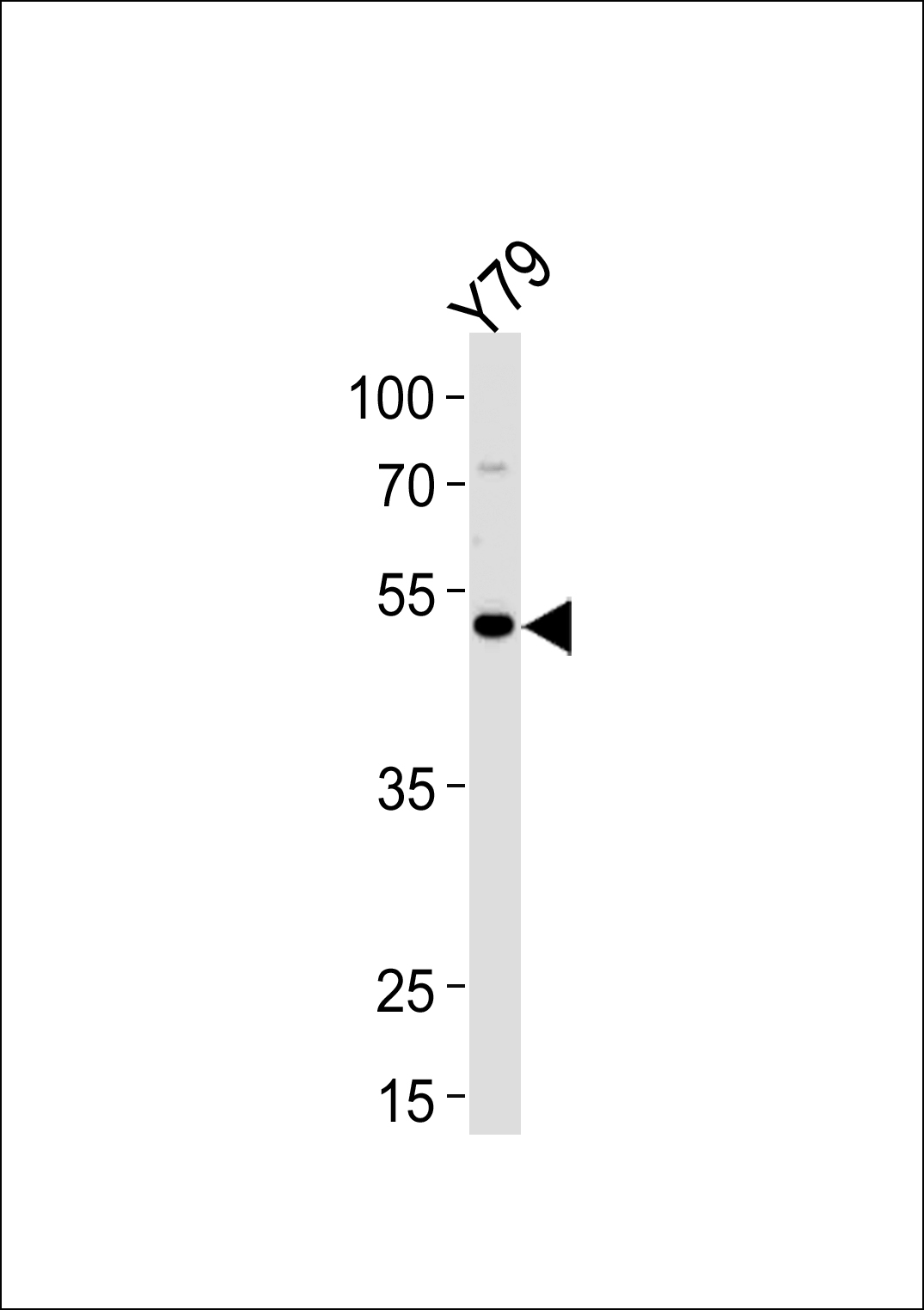 FOXN4 (N-term)