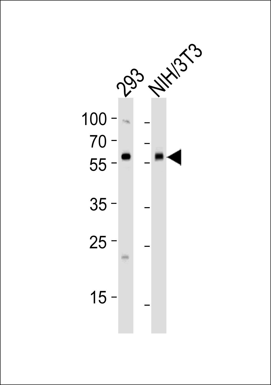 BMPR1A