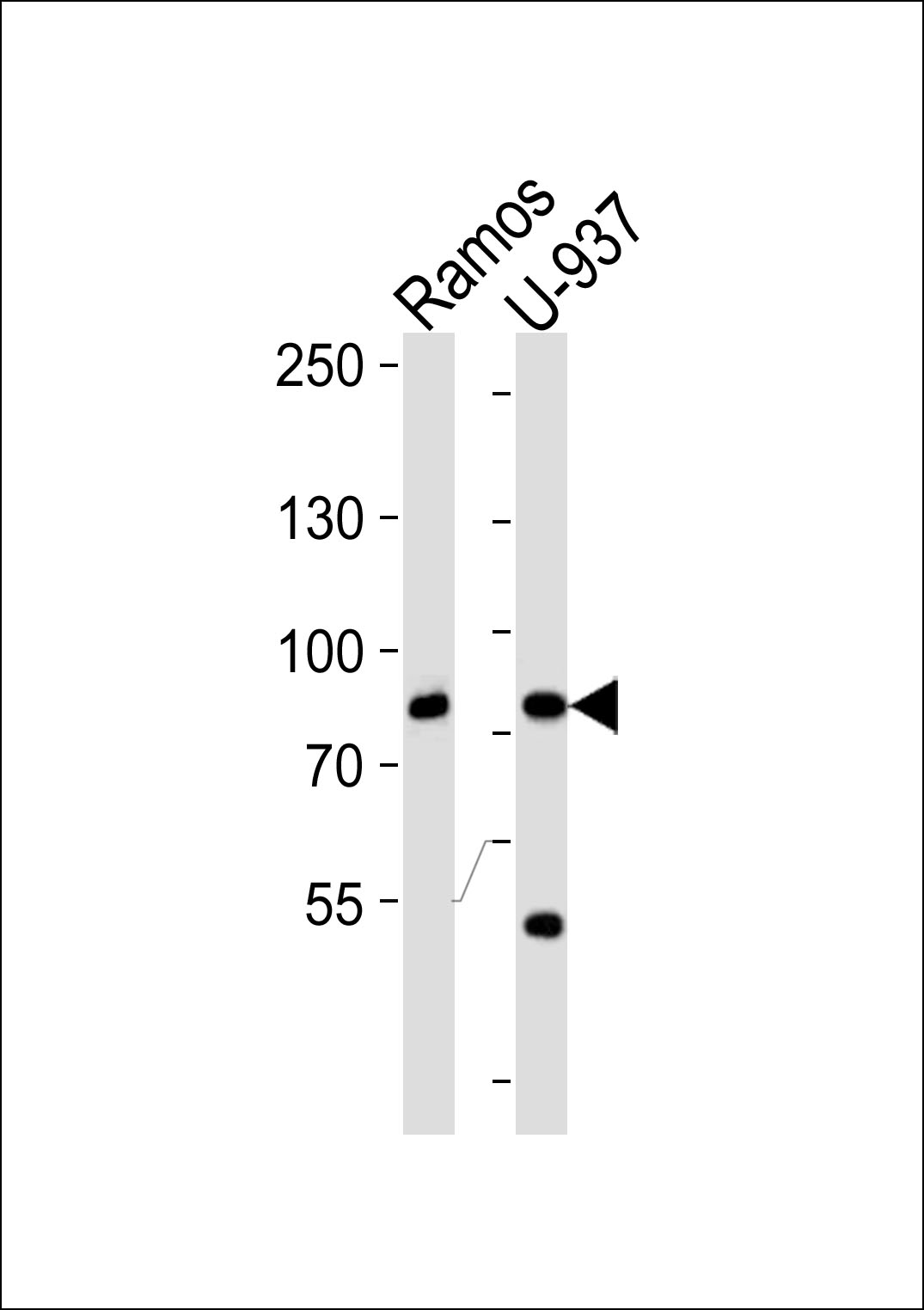 ZC3H11A (N-term)