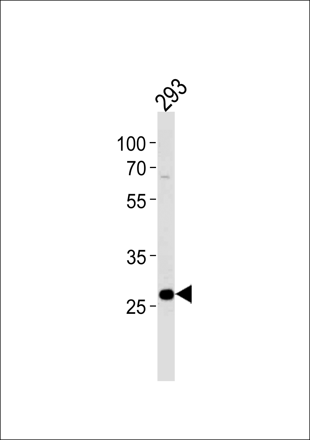 PRB4