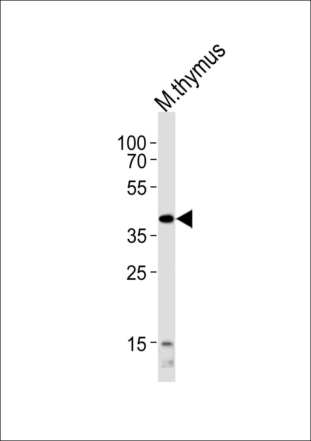 Mouse Tfap2a