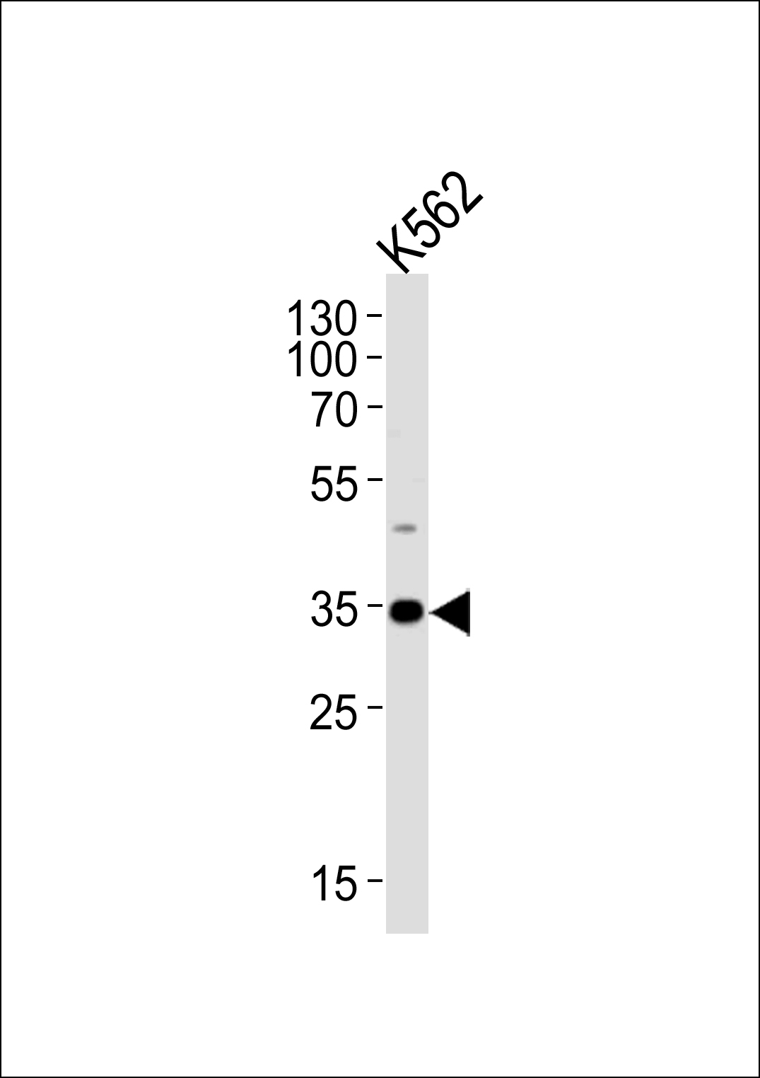 BBS5