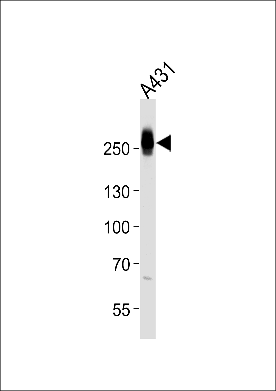 MYH14