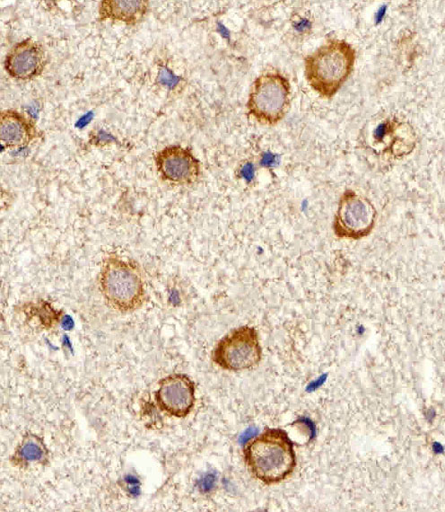 Rabbit Polyclonal Antibody to MYH14