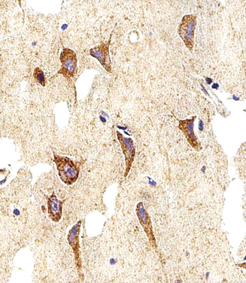 Rabbit Polyclonal Antibody to MYH14