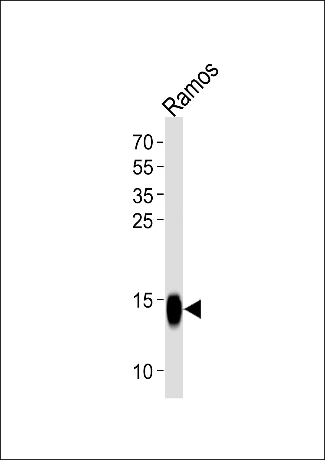 TCL1A