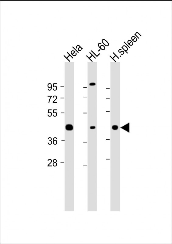 Rabbit Polyclonal Antibody to AK4