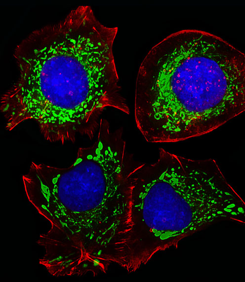 Rabbit Polyclonal Antibody to AK4