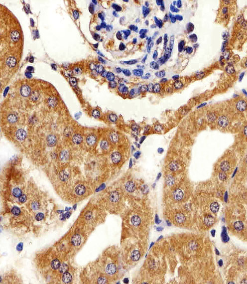 Rabbit Polyclonal Antibody to AK4