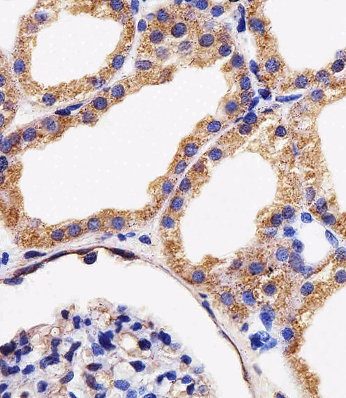Rabbit Polyclonal Antibody to AK4