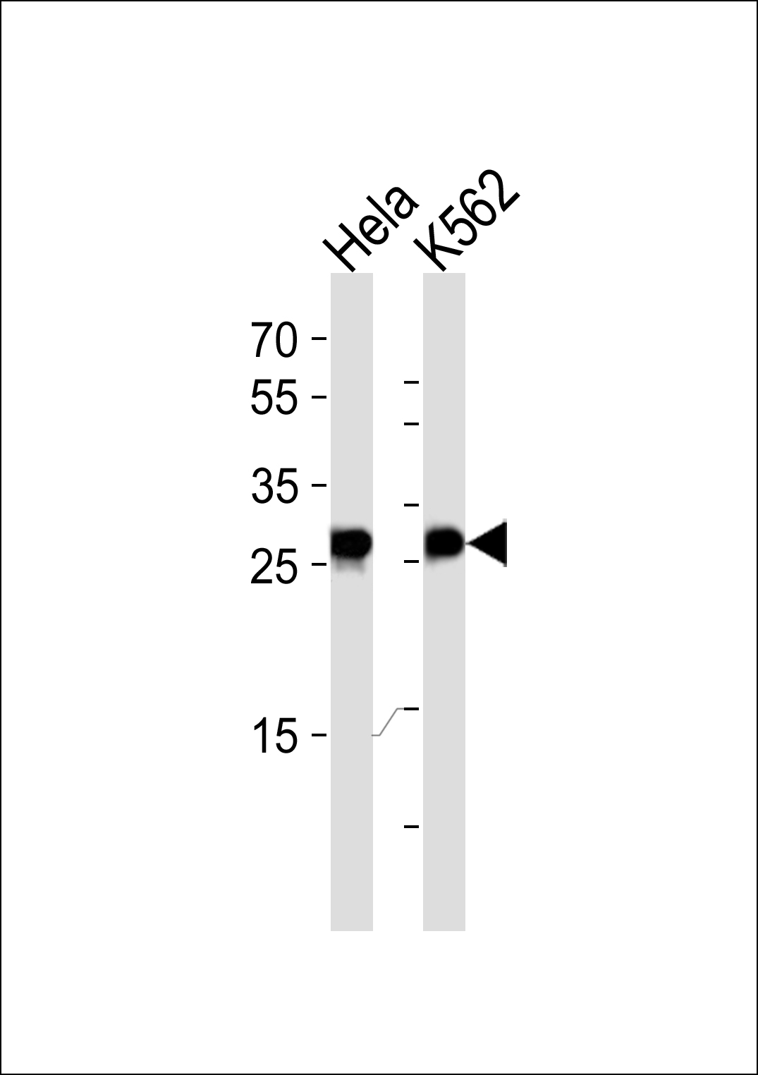EEF1B2
