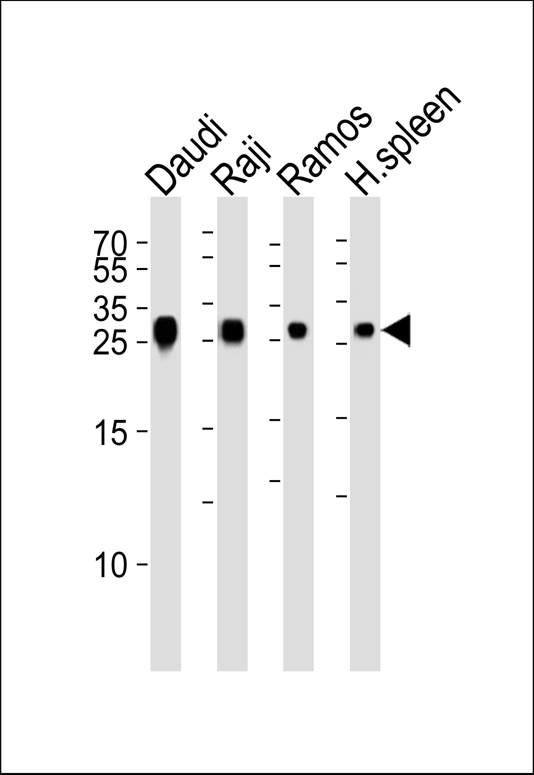 HLA-DRB1