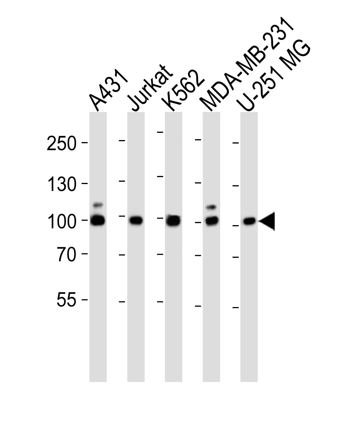 ZNF175 (N-term)