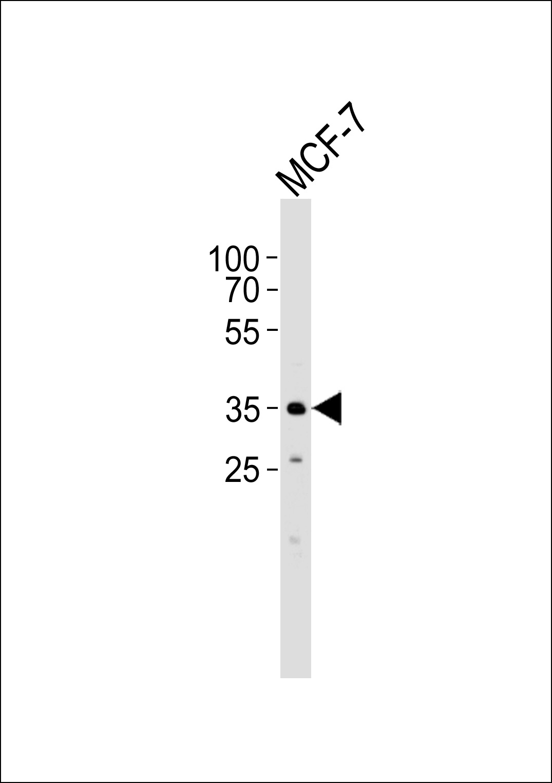 FBXL17 Isoform 2