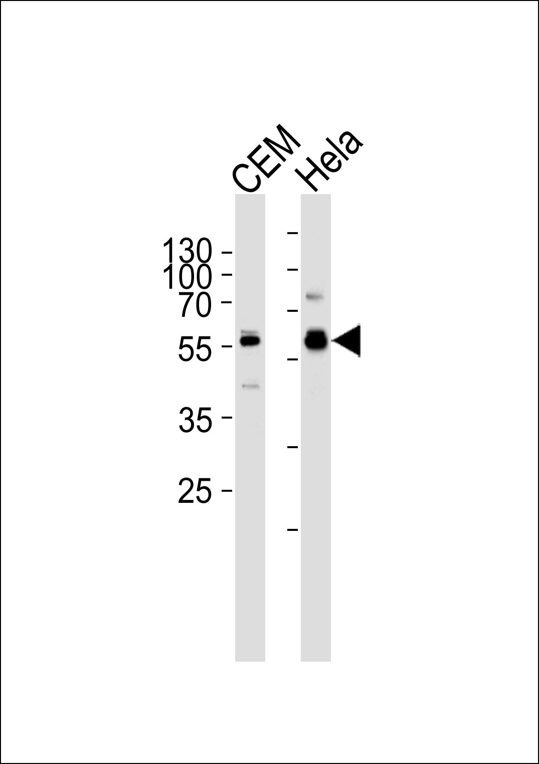 DYRK2 (N-term)