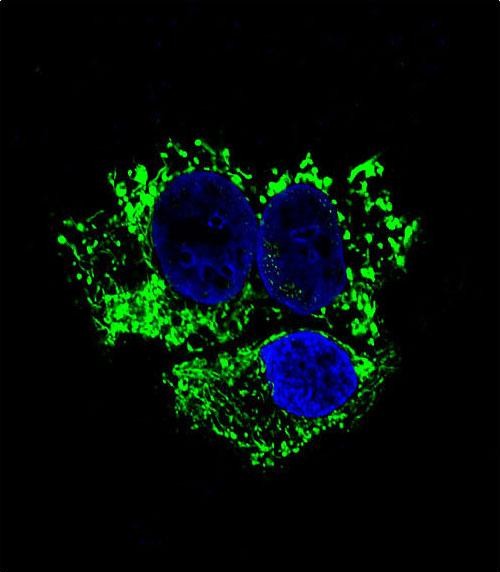 Mouse Monoclonal Antibody to ALDH2